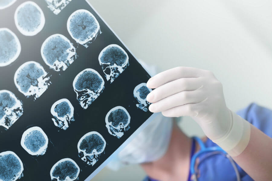 Traumatic Brain Injury Claim