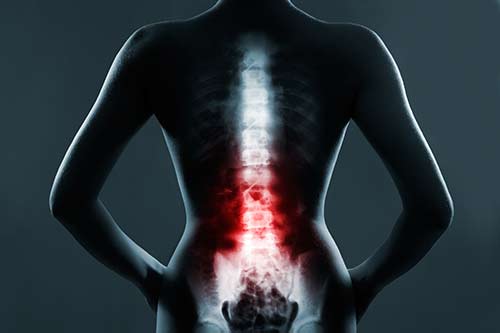 Workers’ Compensation Claims Related To Spinal Cord Injuries