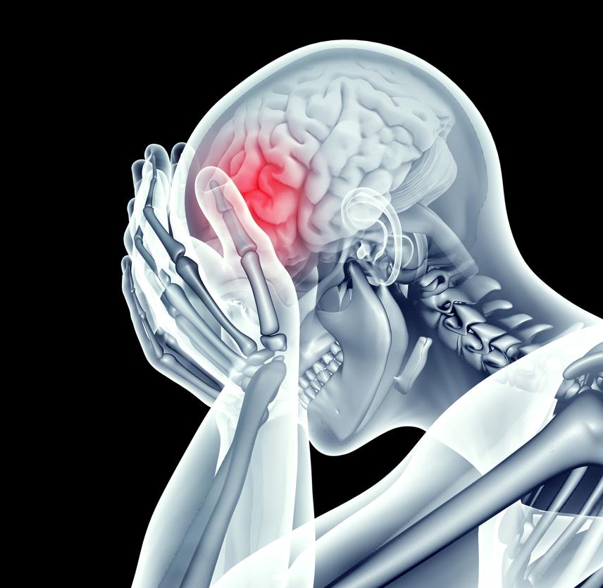 Brain Injury Settlement